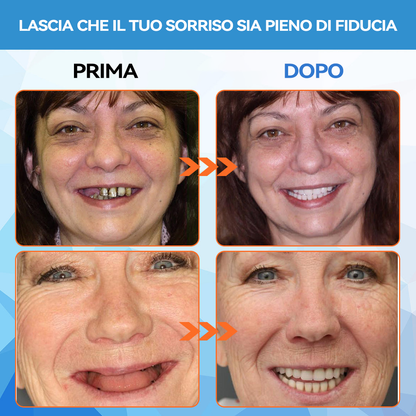 𝐁𝐢𝐤𝐞𝐧𝐝𝐚™ Set di protesi dentarie in silicone (⏰Offerta limitata, solo 30 minuti⏰) 🛩️